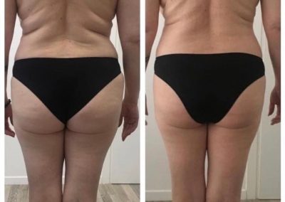 prima e dopo corpo